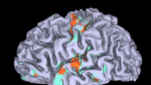 Un chip nel cervello aiuta i malati di Parkinson a camminare