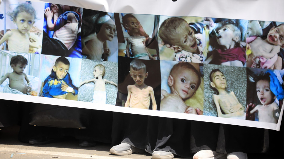 Msf, a Gaza un quarto dei bimbi e delle mamme &egrave; malnutrito