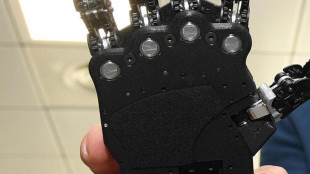 La mano bionica ora pu&ograve; percepire forma e movimento delle cose