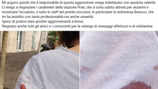 Donna ferita da piombino a Roma, in caserma il presunto responsabile