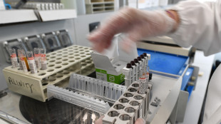 Scoperto un gene chiave che pu&ograve; influenzare la longevit&agrave;