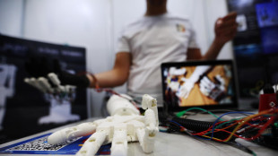 Testato con successo arto robotico 'extra', pu&ograve; sentire il tatto